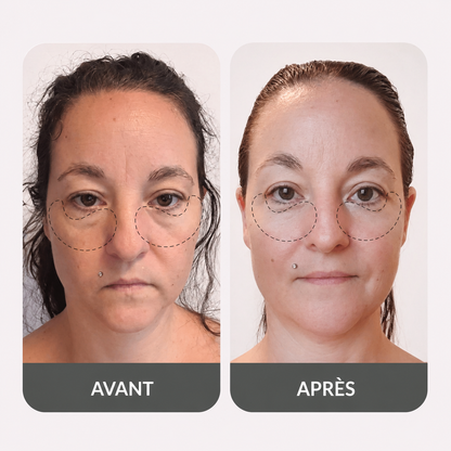 Lunettes Contour des Yeux LED & Micro-Courant